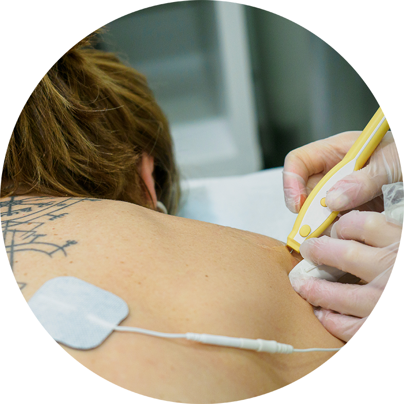 Diatermia fisioterapia